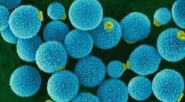 Cryptococcus_neoformans_hires-1-1-2