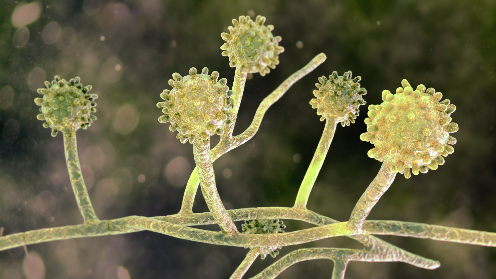 histoplasma